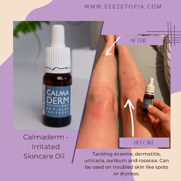 Instagram post informing about benefits of calming oils by Eeezetopia